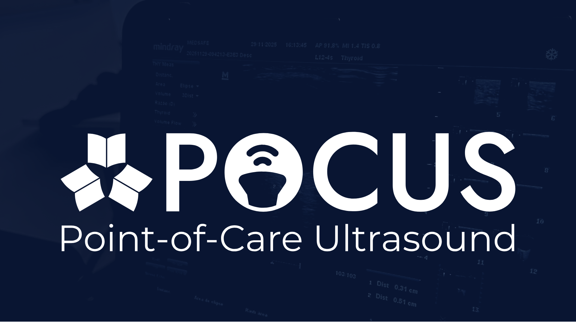 Método Pocus — Point of Care Ultrasound